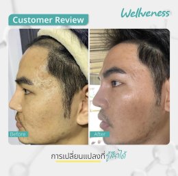 แอมพลูเซรั่ม - เซราไบร์ทครีม