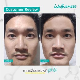 แอมพลูเซรั่ม - เซราไบร์ทครีม