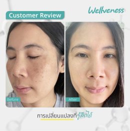 แอมพลูเซรั่ม - เซราไบร์ทครีม