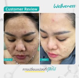 แอมพลูเซรั่ม - เซราไบร์ทครีม