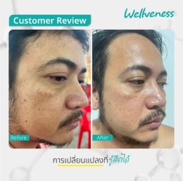 แอมพลูเซรั่ม - เซราไบร์ทครีม