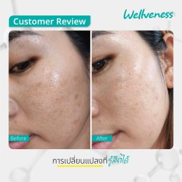 แอมพลูเซรั่ม - เซราไบร์ทครีม