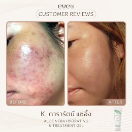 อโรเวล่า