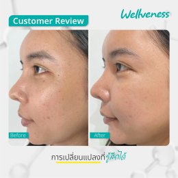 แอมพลูเซรั่ม - เซราไบร์ทครีม