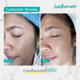 แอมพลูเซรั่ม - เซราไบร์ทครีม