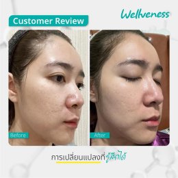 แอมพลูเซรั่ม - เซราไบร์ทครีม