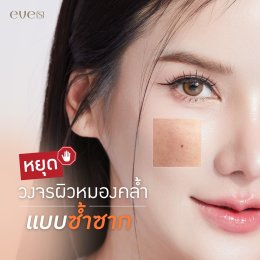 หยุดวงจรผิวหมองคล้ำแบบซ้ำซาก