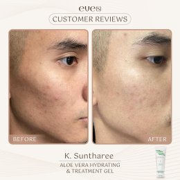 อโรเวล่า