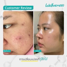 แอมพลูเซรั่ม - เซราไบร์ทครีม