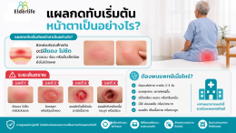 แผลกดทับเริ่มต้นหน้าตาเป็นอย่างไร? ระยะอันตราย + ต้องพบแพทย์เมื่อไหร่?
