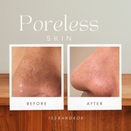 PORELESS SKIN