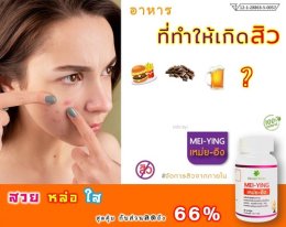 อาหารที่ทำให้เกิดสิว?