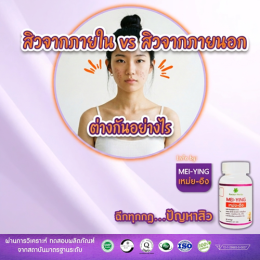 สิวจากภายใน vs สิวจากภายนอก ต่างกันอย่างไร