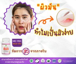ผิวมัน ทำไมเป็นสิวง่าย
