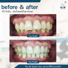 เคสรีวิว