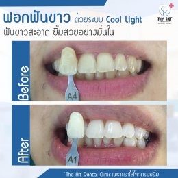 เคสรีวิว