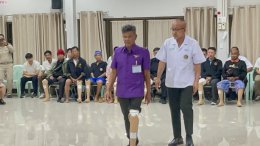 มูลนิธิขาเทียมในสมเด็จพระศรีนครินทราบรมราชชนนี ออกหน่วยพระราชทานเคลื่อนที่จัดทำขาเทียม