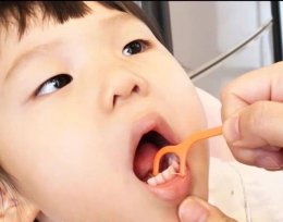  XYLITOL FLOSSY ไหมขัดฟันสำหรับเด็ก