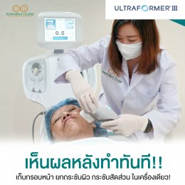 โปรแกรม​ULTRAFORMER III