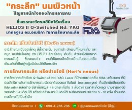 ❗❗"ก​ระลึก​" บนผิวหน้า❗❗ ปัญหาหนักใจของใครหลายคน