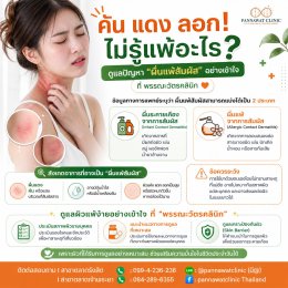   คันดูแลปัญหา ผื่นแพ้สัมผัส อย่างเข้าใจ ที่ พรรณะวัตรคลินิก  เนื้อหา: เคยไหมคะ? 