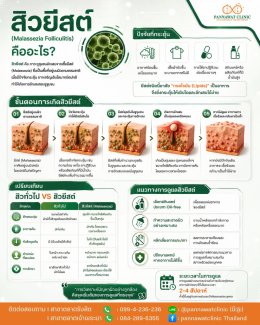  สิวยีสต์ คืออะไร? ทำไมทายาสิวแล้วไม่ค่อยดีขึ้น?