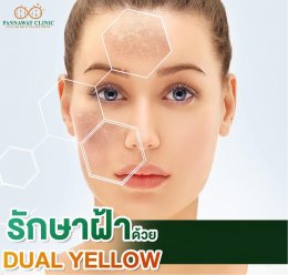 รักษาฝ้าด้วย​โปรแกรม​ Dual Yellow