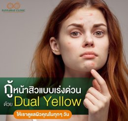 รักษาสิวด้วย Dual Yellow