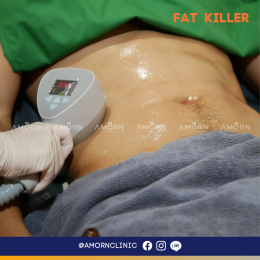 FAT KILLER สลายไขมัน ยกกระชับ