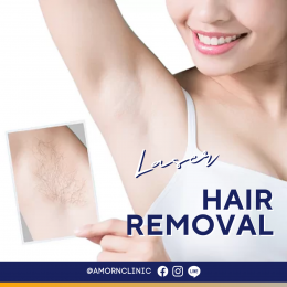 LASER HAIR REMOVAL | เลเซอร์กำจัดขน