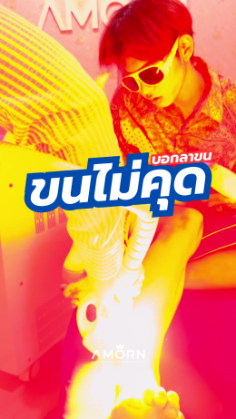 เลเซอร์กำจัดขน