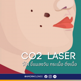 Co2 Laser (กำจัดไฝ ขี้แมลงวัน ติ่งเนื้อ กระเนื้อ สิวหิน)