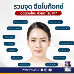 ฺBotulinum Toxin | ที่สุดของ “การลดริ้วรอย” 