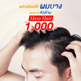 Meso Hair (เมโสปลูกผม)