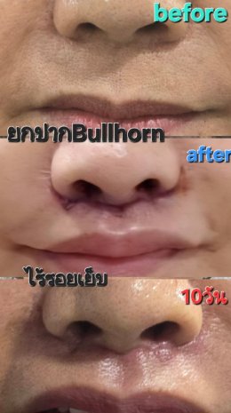 bullhorn3