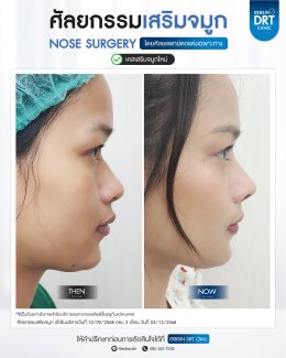 ศัลยกรรมจมูก