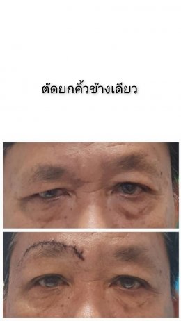 ยกคิ้ว