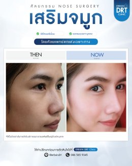 Review Nose Silicone