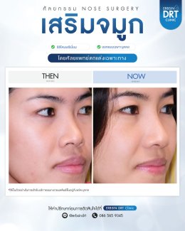 Review Nose Silicone