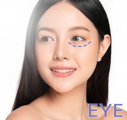 High Eyelid crease and fold  Cause and correction