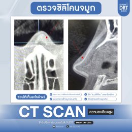 CT Scan จมูก