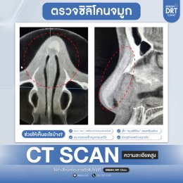 CT Scan จมูก