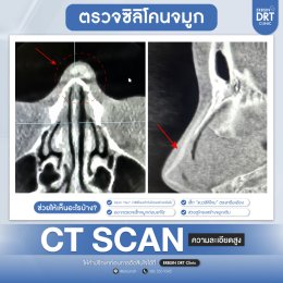 CT Scan จมูก