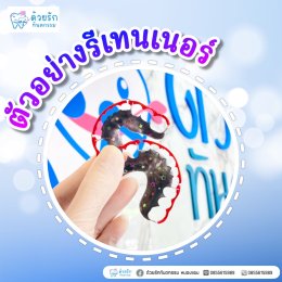 ตัวอย่างรีเทนเนอร์