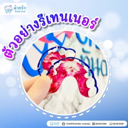 ตัวอย่างรีเทนเนอร์