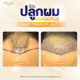 Salepage Review