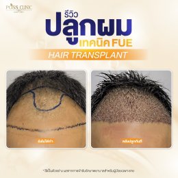 Salepage Review