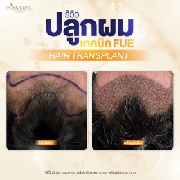 Salepage Review