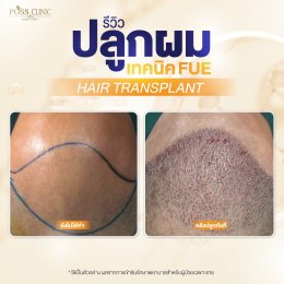 Salepage Review