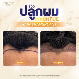 Salepage Review